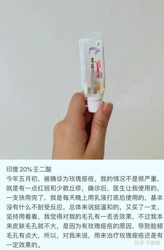 壬二酸20%杜鹃花酸