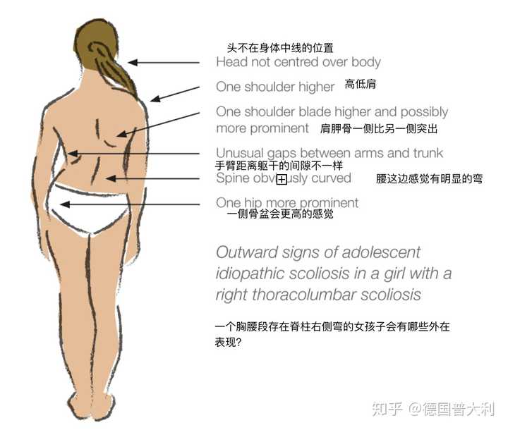 为什么我左胸比右胸大,而右背比左背宽,而且左脸和右脸还不一样?