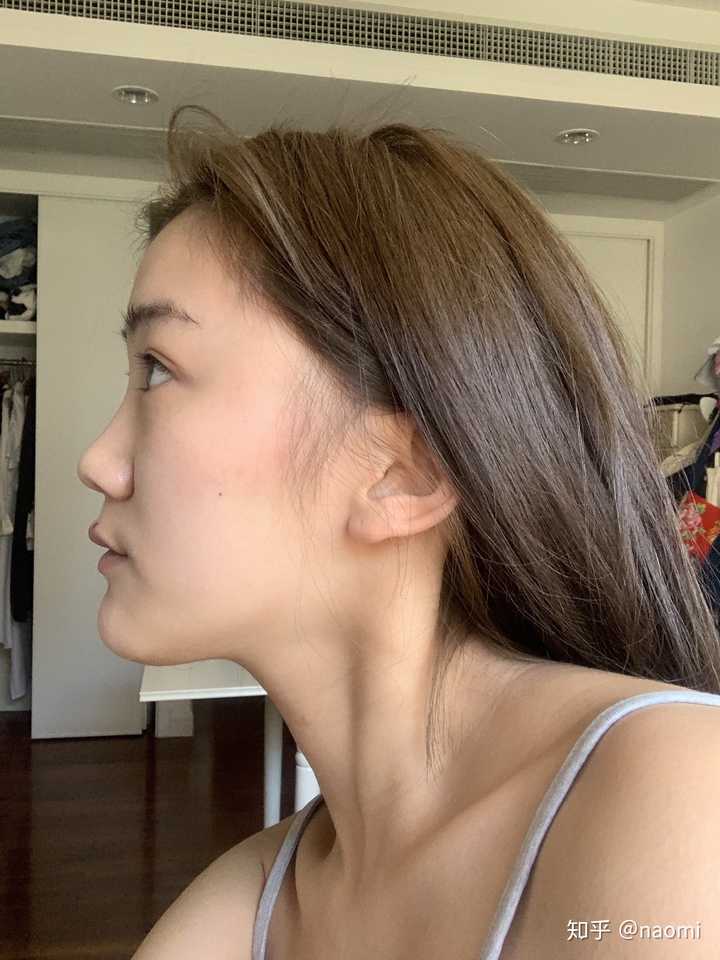 侧脸丑而正脸好看是一种什么体验?