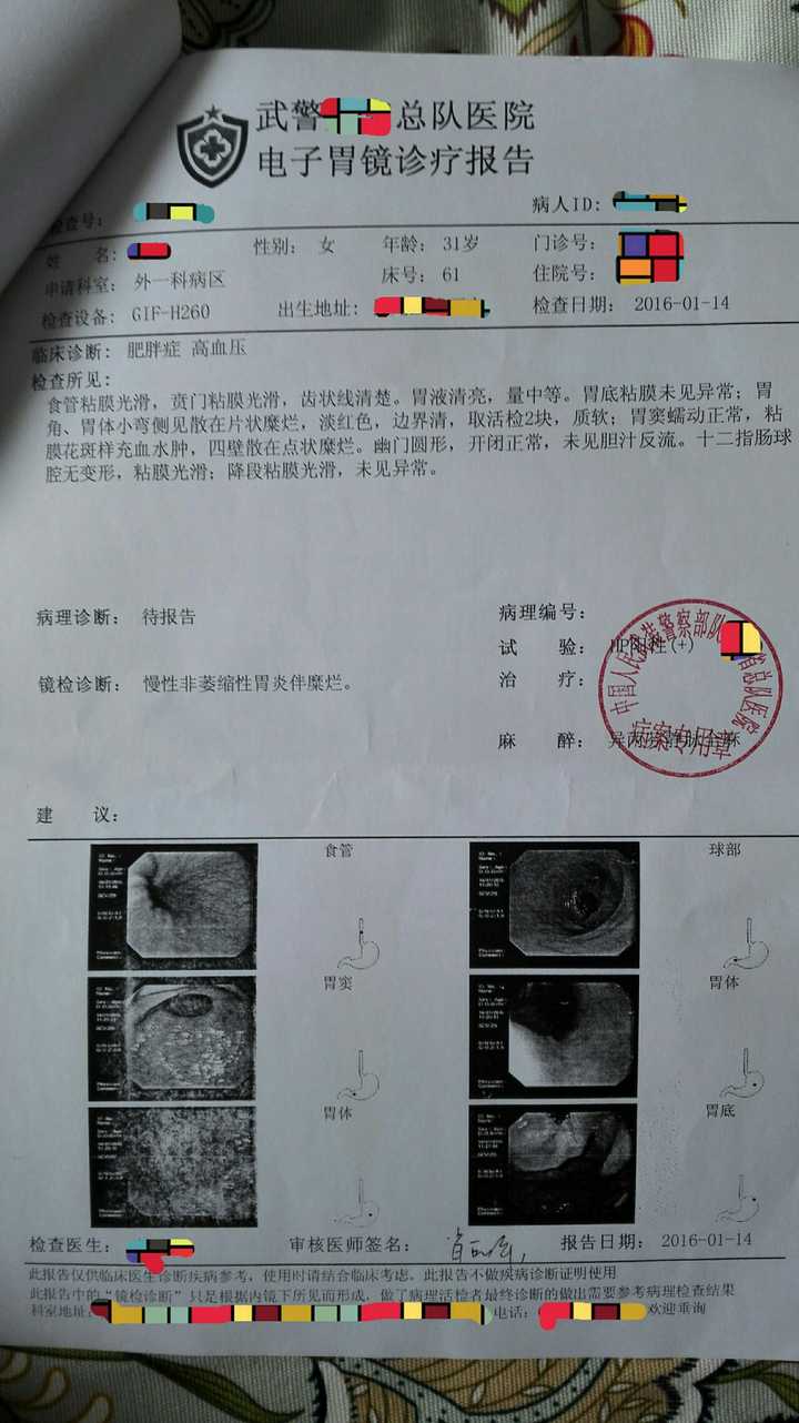 我很胖,想去做胃袖状切除手术,希望懂的人来谈下后遗症!