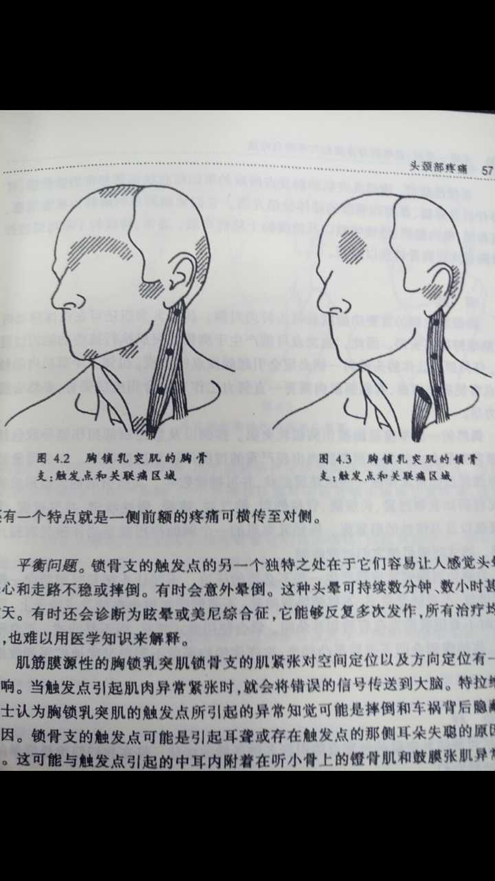 腰肌劳损/背部筋膜炎/背痛怎么判断和康复?