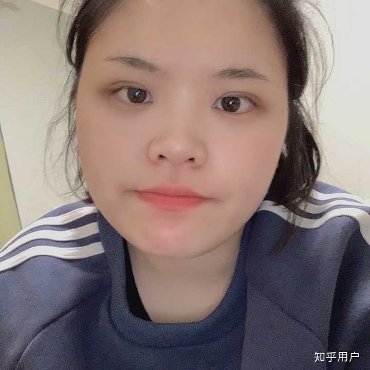 窄额头发际线低可能真的没未来吧,微笑jpg?