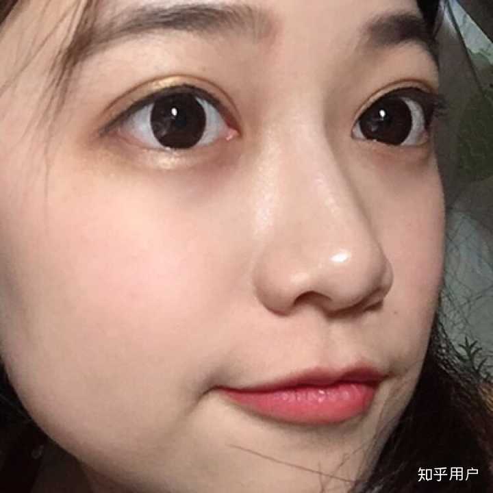 天生双眼皮太像割的是一种什么体验?