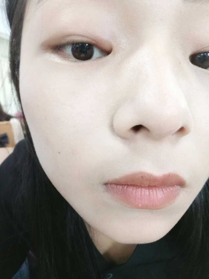 就揉了揉,第二天,发现长了麦粒肿 毁容了,没脸见人了,那你看