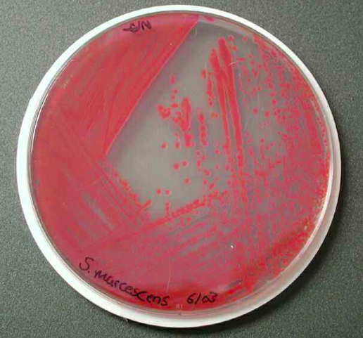 在培养皿中的呈鲜红色的「粘质沙雷氏菌(serratia marcescens)