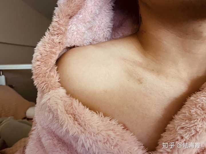 忍不住在他锁骨上种草莓