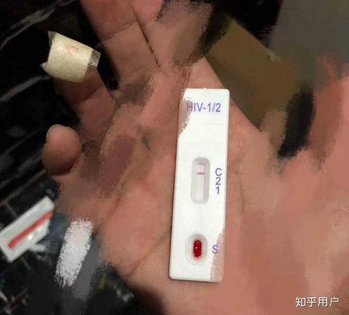 hiv检测初筛假阳是怎样的经历?