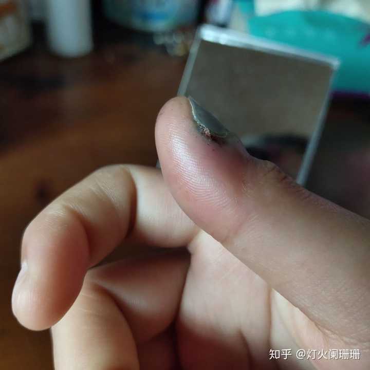 手被车门夹了怎么办?