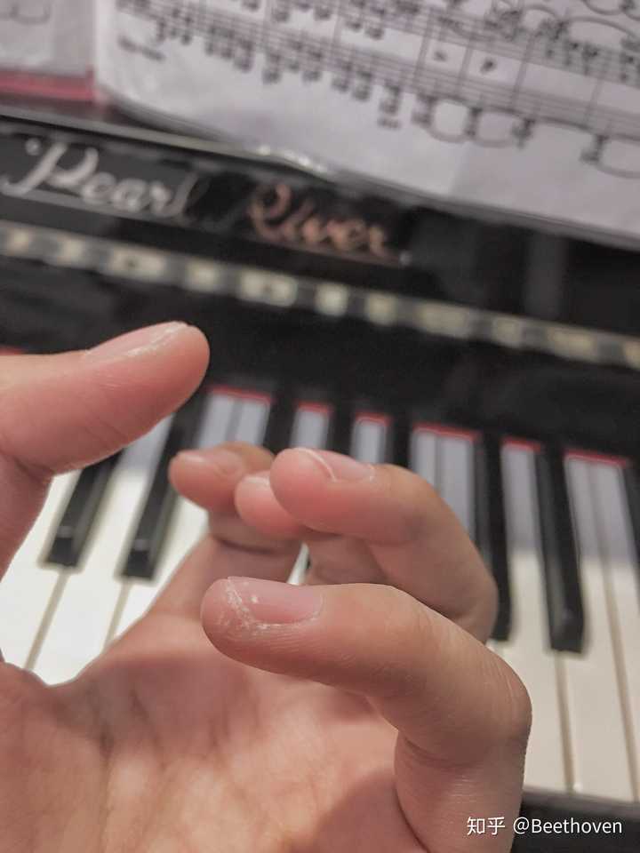 弹钢琴的人的手和普通人有区别吗?