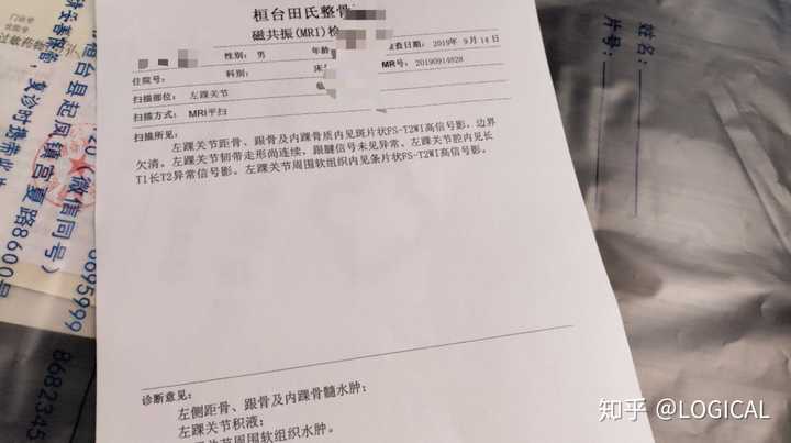 脚崴了伤到筋4个月都没好