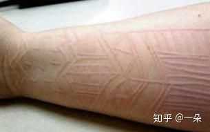 你有哪些特别奇特的生理反应?