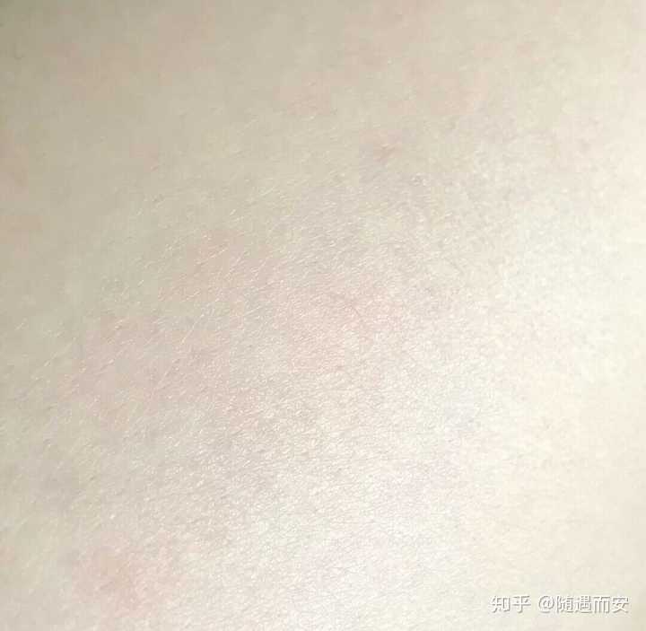 姑娘们的比基尼区怎么脱毛?
