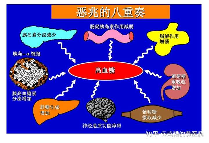 糖尿病的发病机制很复杂,不是单一因素可以解释的,目前比较公认的是