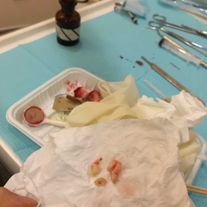 我的牙 还连着肉