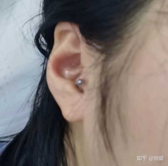 请问耳屏打耳洞会很疼吗?