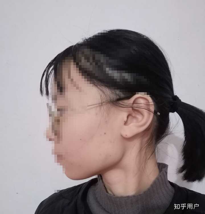 175 女生,方脸短额头没下巴适合什么发型?