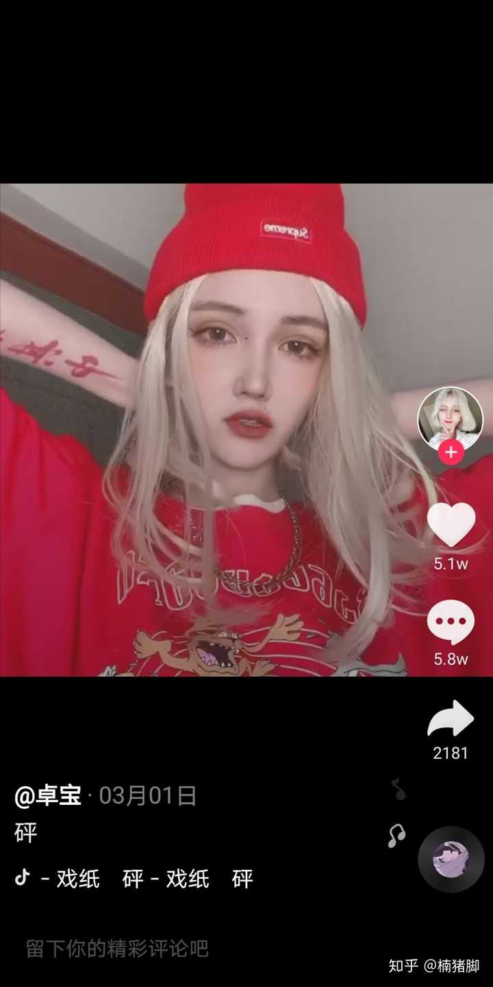 你最讨厌抖音里哪个网红?