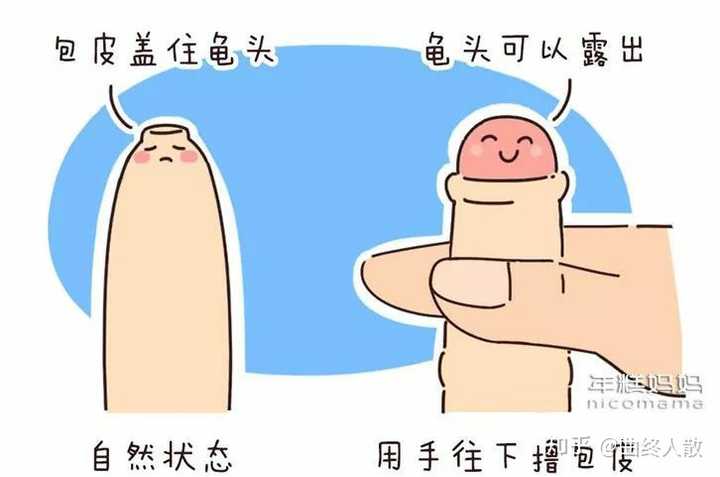 必须要割包皮吗不割行不行啊