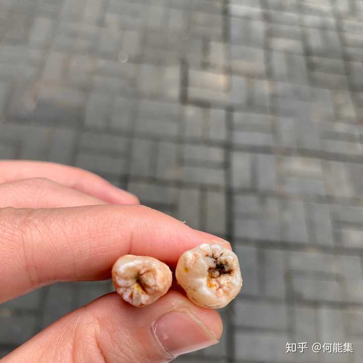 牙齿很大是一种什么样的体验