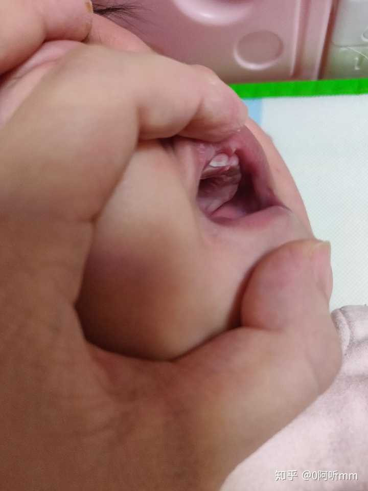 婴儿长牙是怎样的?