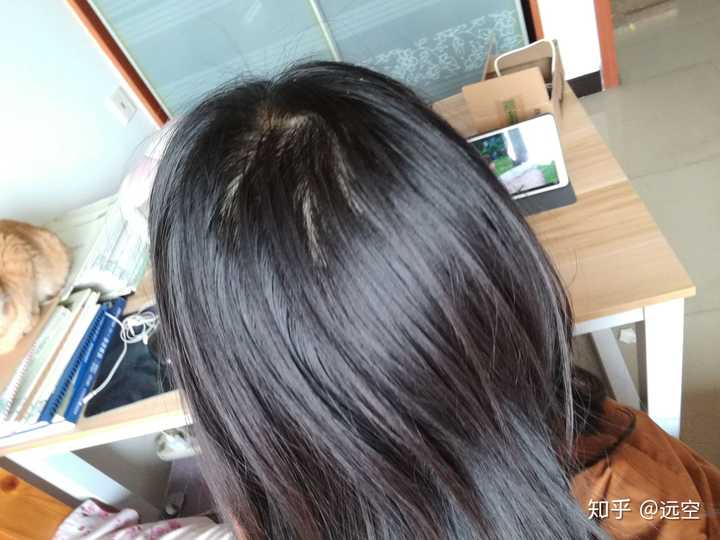 女生 发量少 头顶快秃了 有没有什么好的生发方法!跪求!