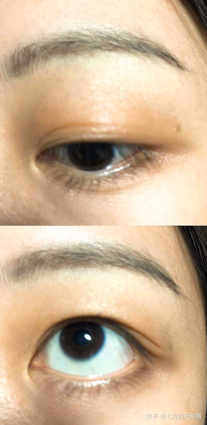 你们眼睛有没有经常睡起来以后发现自己眼睛已经肿出一片天际?