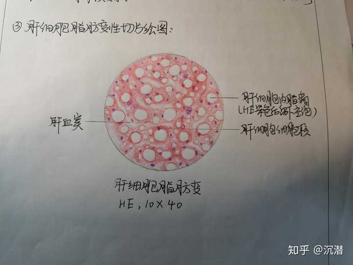 如何用红蓝铅笔画出好看的切片图