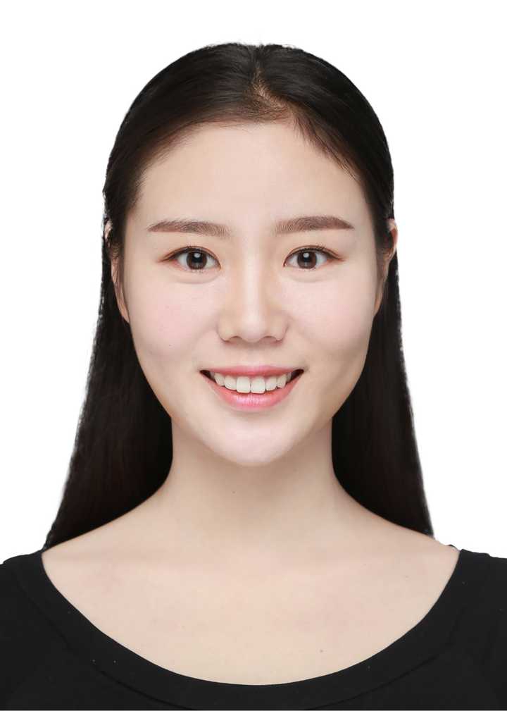 平常不露齿笑就是正常下巴,一旦露齿笑几乎都会问是不是真下巴.