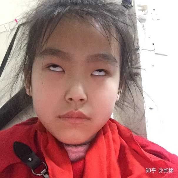 瞪眼翻白眼就对了.