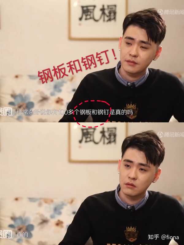 张云雷的108块钢板都在哪里怎么装上去的?