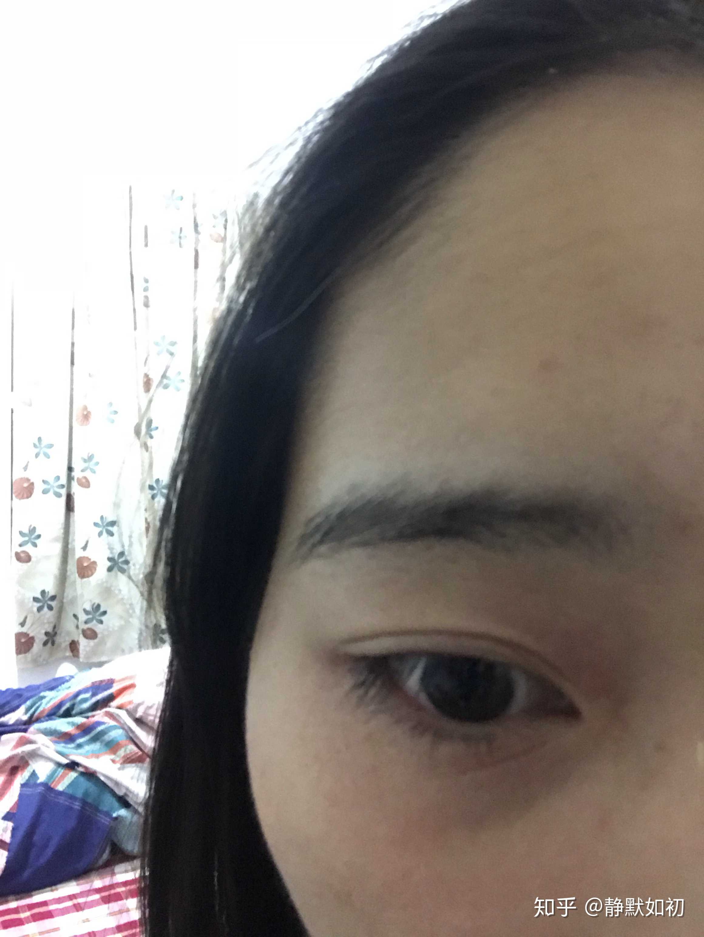 22岁,眼睛下边长了这么多皱纹,半个月前… - 知乎