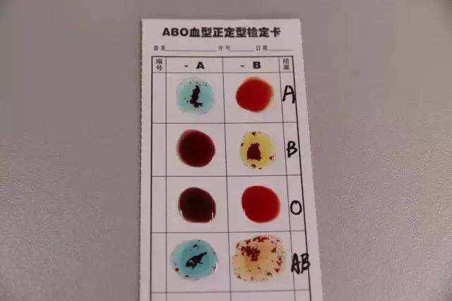 后来我在查询了资料后得知,这张划有格子的纸叫" abo血型正定型检定