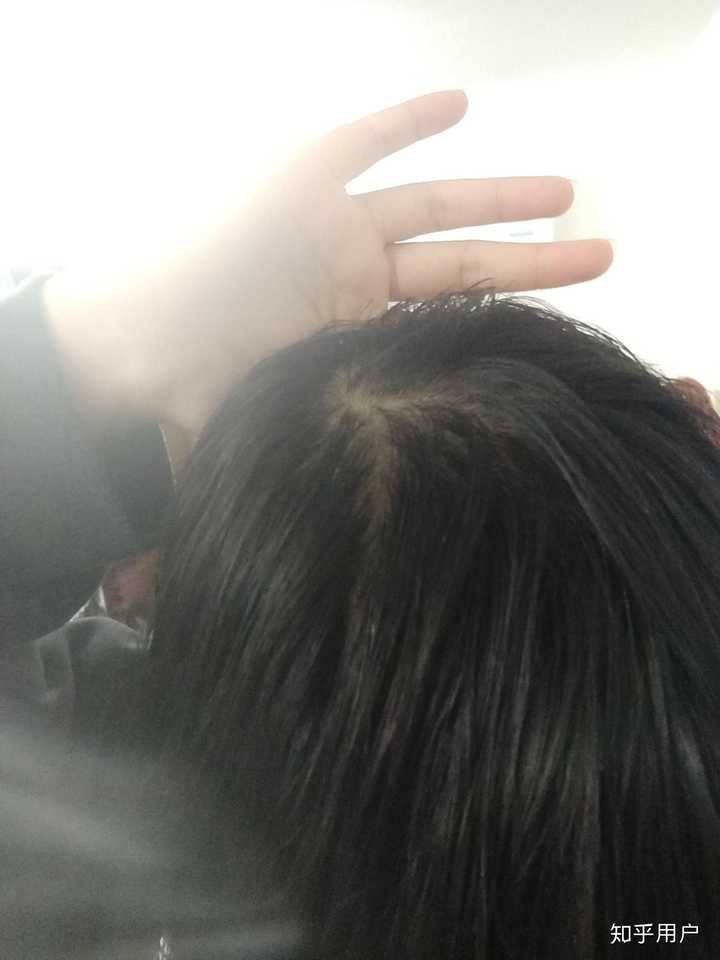 大冬天头发都一天就油.