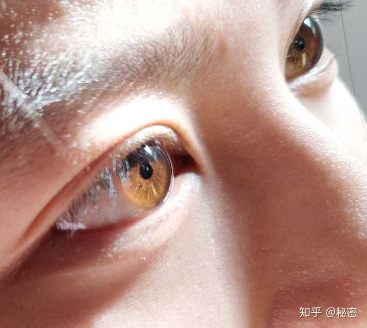 为什么有些中国人的眼睛是棕黄色的