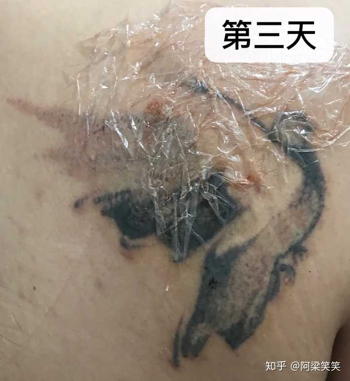 洗纹身是种什么样的体验