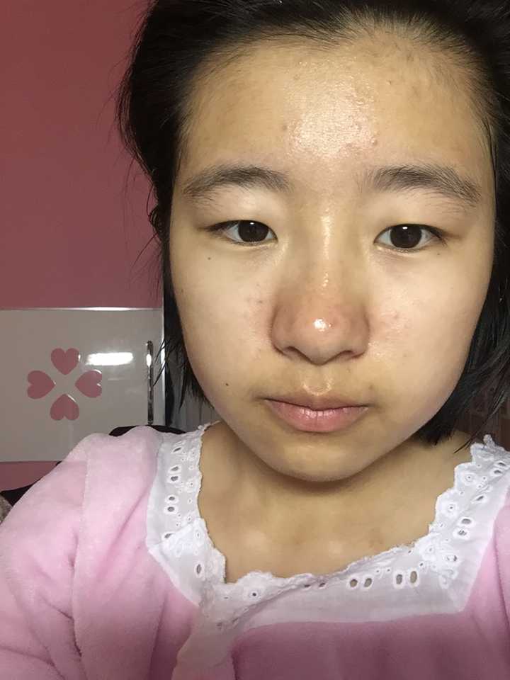 17岁少女应该用什么护肤品