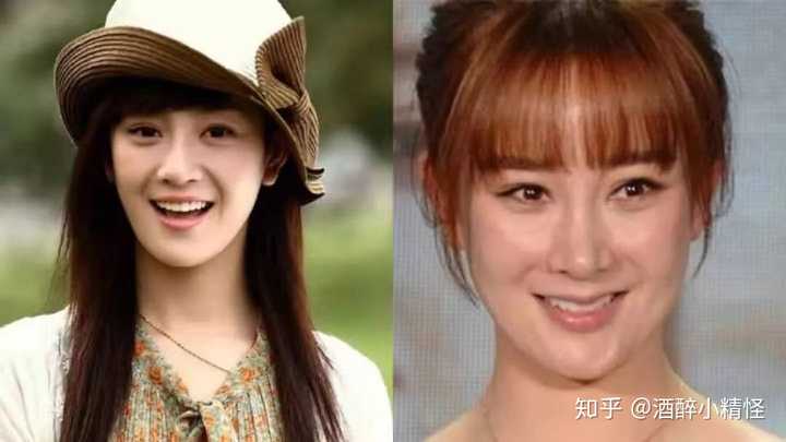 那些整容大变脸的女星到了老年会是什么体验,求科普?