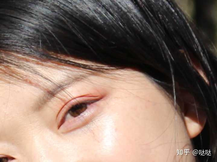 熬夜真的能从双眼皮熬出三眼皮吗?