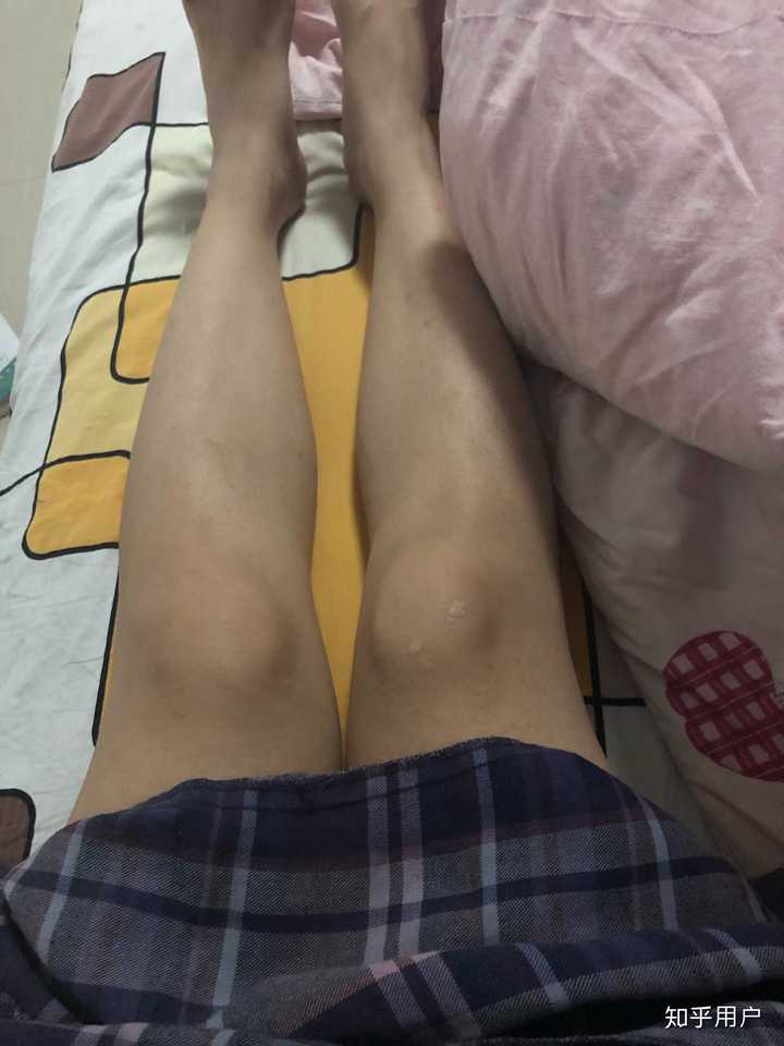 男生和女生膝盖有什么差别呢?