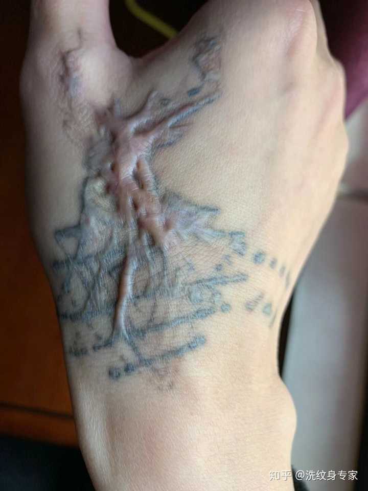 满背纹身可以洗干净吗?