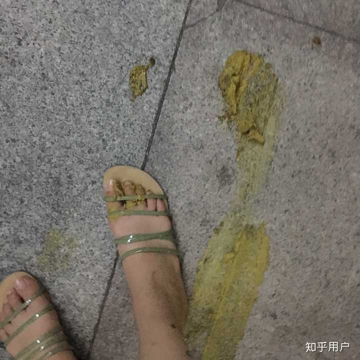 走路踩到屎是怎样一种体验?