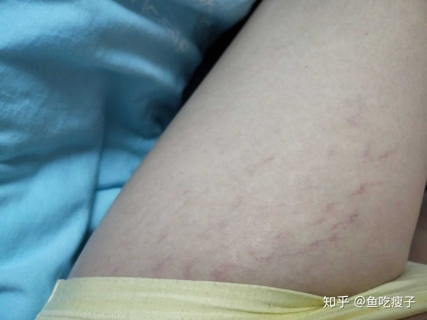 女人生完孩子后肚子的真实状态是怎样的?