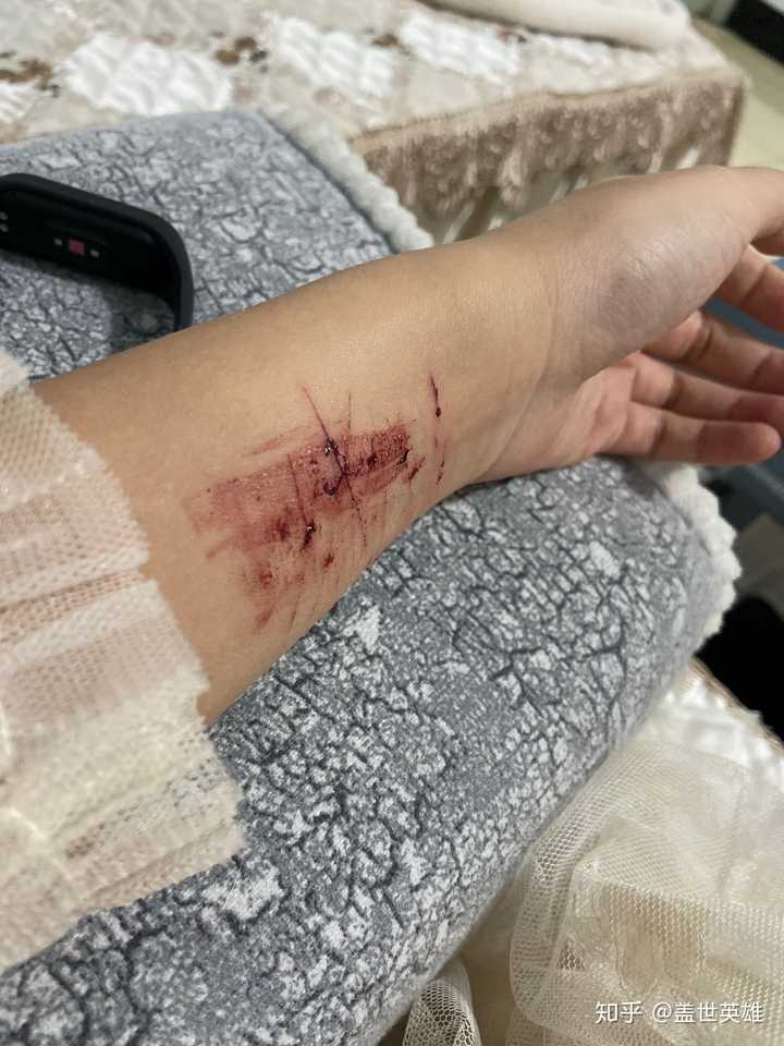 哪些话不宜对抑郁症患者说?
