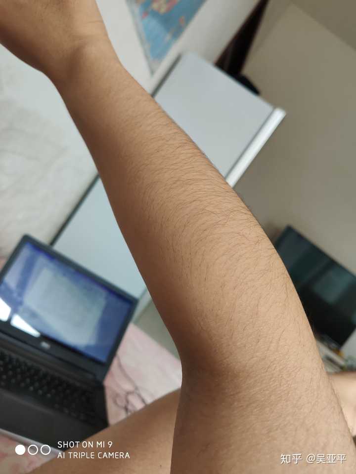 女生体毛多是种怎样的体验?