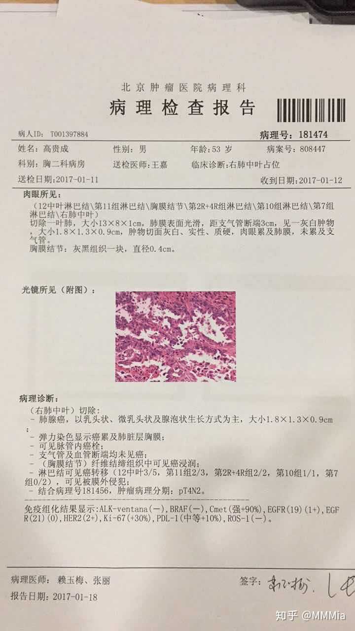 肿瘤标志物检验用于肺癌诊断的临床价值评价