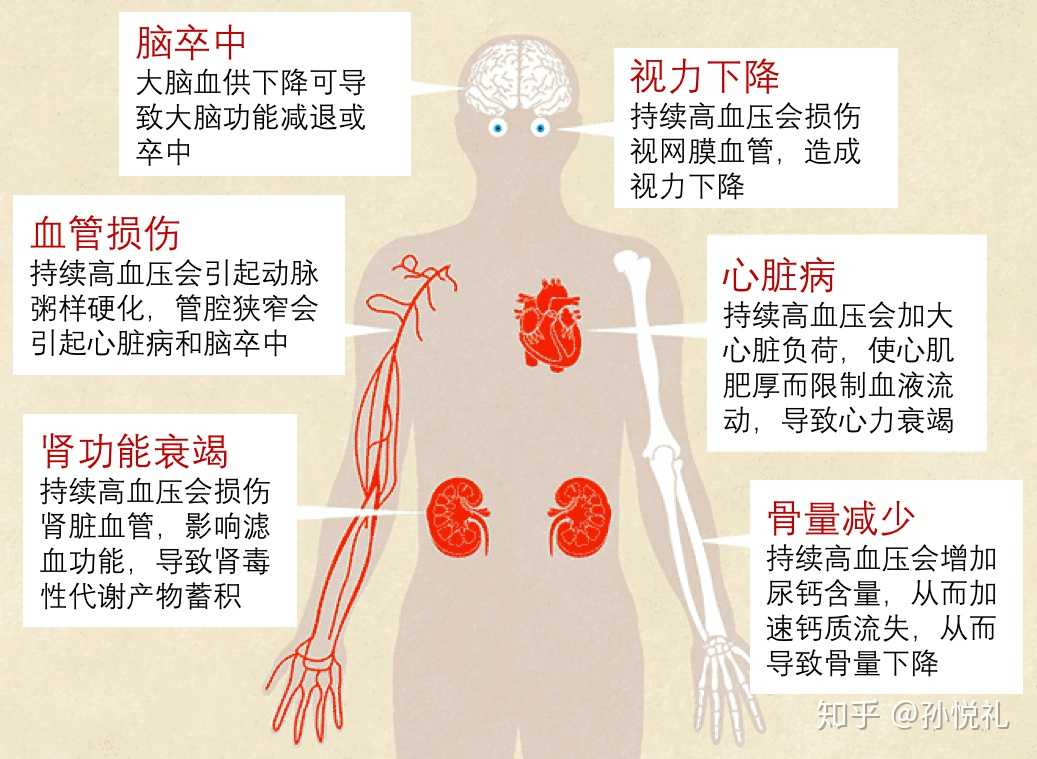 写立项背景时做了两页不错的图文,顺便科普下高血压的各种并发症和