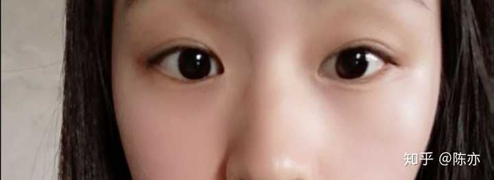 内双或扇形双眼皮可以有多好看?