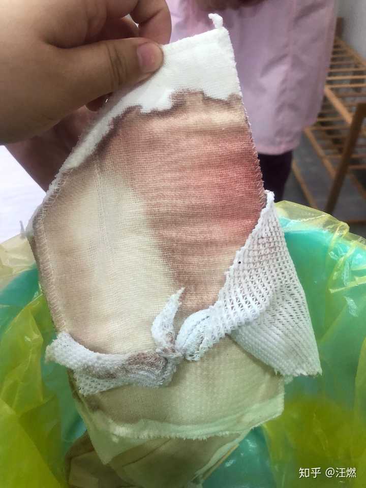 国内植发最好的机构有哪些?