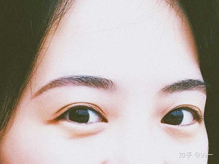 怎样让自己眼睛有神?
