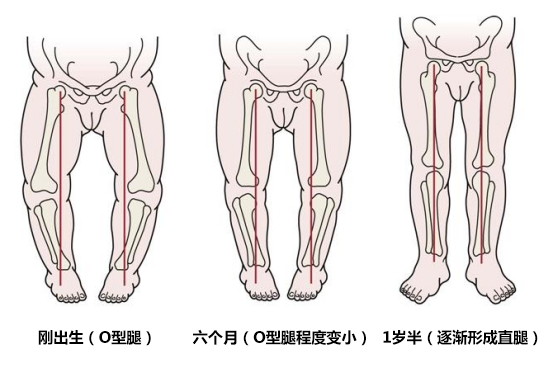 宝宝一岁之前都是o型腿,3-6岁是x型腿,这种说法是真的